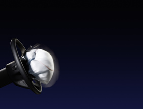 Mercedes Benz (2011) - Entfaltung des Airbags in fünf Bildern - Bild 3